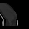 SPORK, NICO - 22.03.1976 - 02.08.2022 - CT obere Extremität - 18:01:46